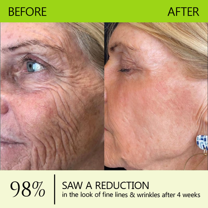🎖️🎖️🎖️Made and shipped from USA 💫Healrize® Botox & Vita-A Retinol Shot Wrinkle-Lift Tightening cream - Last Day Promotion 70% OFF