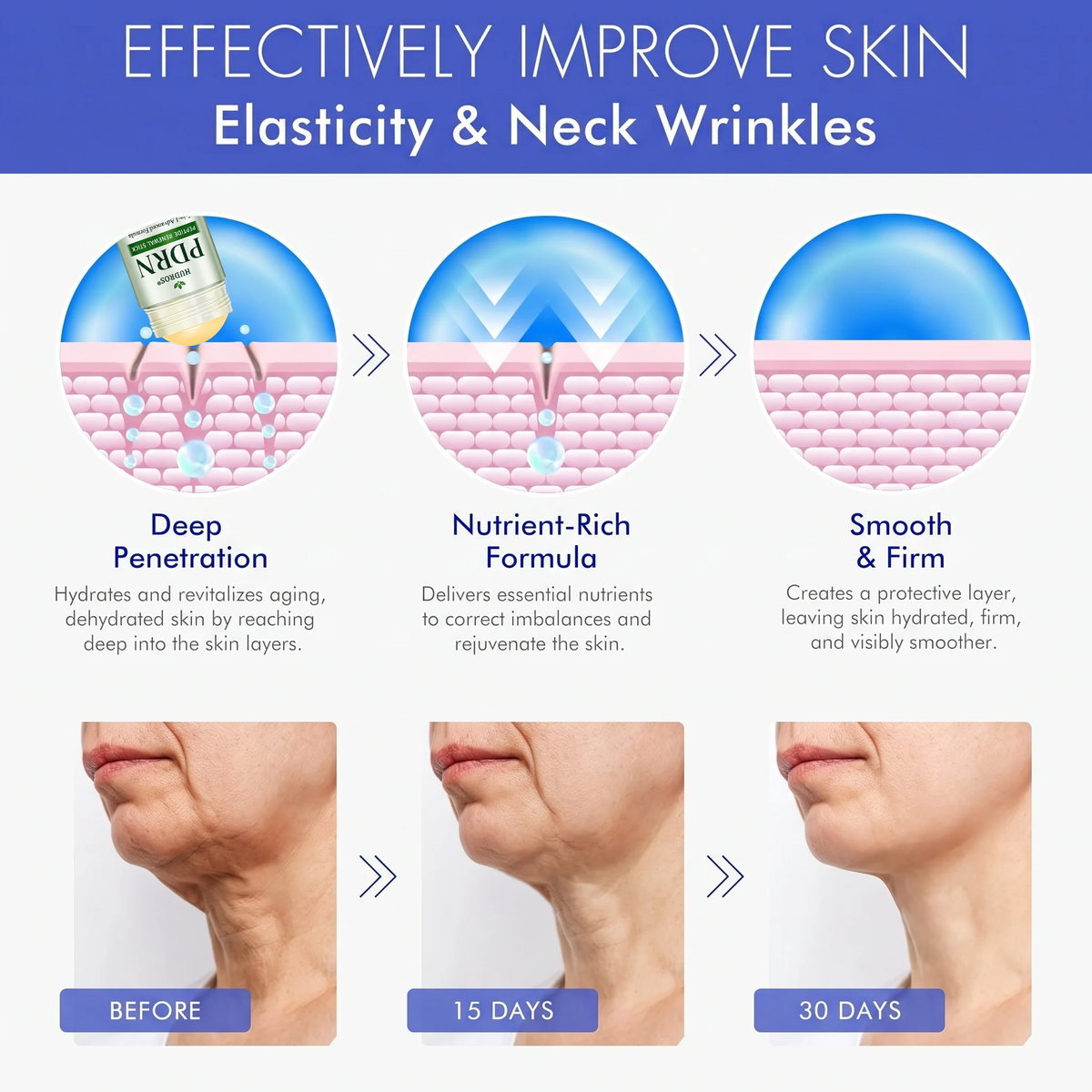 Hudros® 👨‍⚕️👨‍⚕️𝑷𝑫𝑹𝑵 𝑨𝒏𝒕𝒊-𝑨𝒈𝒊𝒏𝒈 & 𝑻𝒂𝒓𝒈𝒆𝒕𝒆𝒅 𝑺𝒑𝒐𝒕 𝑹𝒆𝒏𝒆𝒘𝒂𝒍 𝑺𝒕𝒊𝒄𝒌（𝑯𝒆𝒍𝒑𝒔 𝑺𝒎𝒐𝒐𝒕𝒉 𝑾𝒓𝒊𝒏𝒌𝒍𝒆𝒔, 𝑺𝒖𝒑𝒑𝒐𝒓𝒕 𝑭𝒊𝒓𝒎𝒆𝒓-𝑳𝒐𝒐𝒌𝒊𝒏𝒈 𝑺𝒌𝒊𝒏, 𝒂𝒏𝒅 𝑰𝒎𝒑𝒓𝒐𝒗𝒆 𝑻𝒉𝒆 𝑨𝒑𝒑𝒆𝒂𝒓𝒂𝒏𝒄𝒆 𝑶𝒇 𝑽𝒊𝒔𝒊𝒃𝒍𝒆 𝑺𝒑𝒐𝒕𝒔）🎁