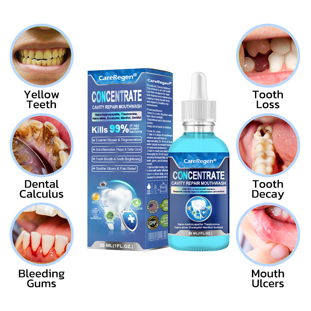 Official Store：🏆CareRegen® CONCENTRATE REPAIR MOUTHWASH(Dentist recommended)(Flying Off the Shelves: 100,000 Bottles Sold!)🎀