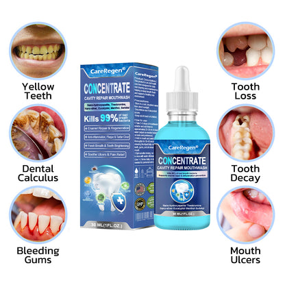 Official Store：🏆CareRegen® CONCENTRATE REPAIR MOUTHWASH(Dentist recommended)(Flying Off the Shelves: 100,000 Bottles Sold!)🎀