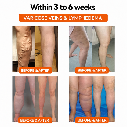 TIMNAMY®👩‍⚕️🧬 Ultrasound Fat Breakdown and Far-Infrared Detoxifying Blood Sugar Balancing Bracelet