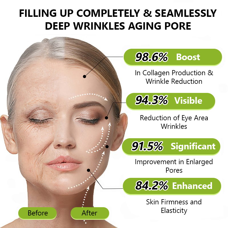 🎖️🎖️🎖️Made and shipped from USA 💫Healrize® Botox & Vita-A Retinol Shot Wrinkle-Lift Tightening cream - Last Day Promotion 70% OFF