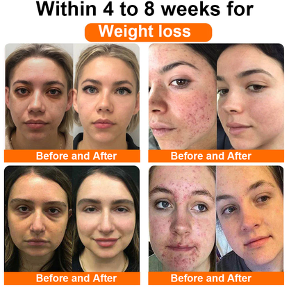 C𝐚𝐫𝐞𝐠𝐞𝐧® 𝐤𝐬𝐦-𝟔𝟔 & 𝐯-𝐩𝐨𝐬𝐢𝐭𝐢𝐯 𝐍𝐚𝐭𝐮𝐫𝐚𝐥 𝐑𝐞𝐩𝐚𝐢𝐫 𝐕𝐚𝐠𝐢𝐧𝐚𝐥 𝐂𝐚𝐩𝐬𝐮𝐥𝐞𝐬
