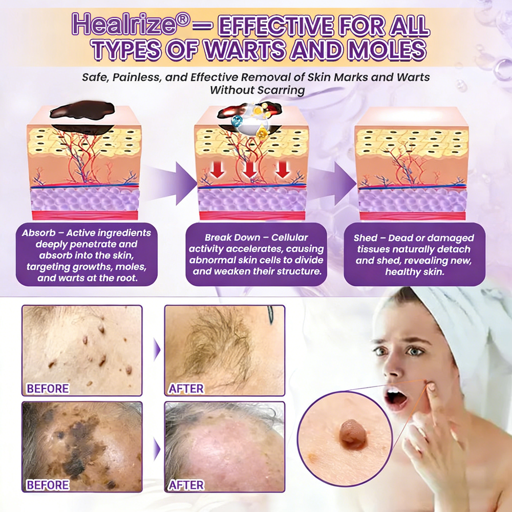 Made and Shipped from UK ✨Healrize® Biotin 10-in-1 Skin Restoration Cream 🍀