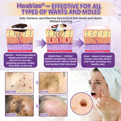 Made and Shipped from UK ✨Healrize® Biotin 10-in-1 Skin Restoration Cream 🍀