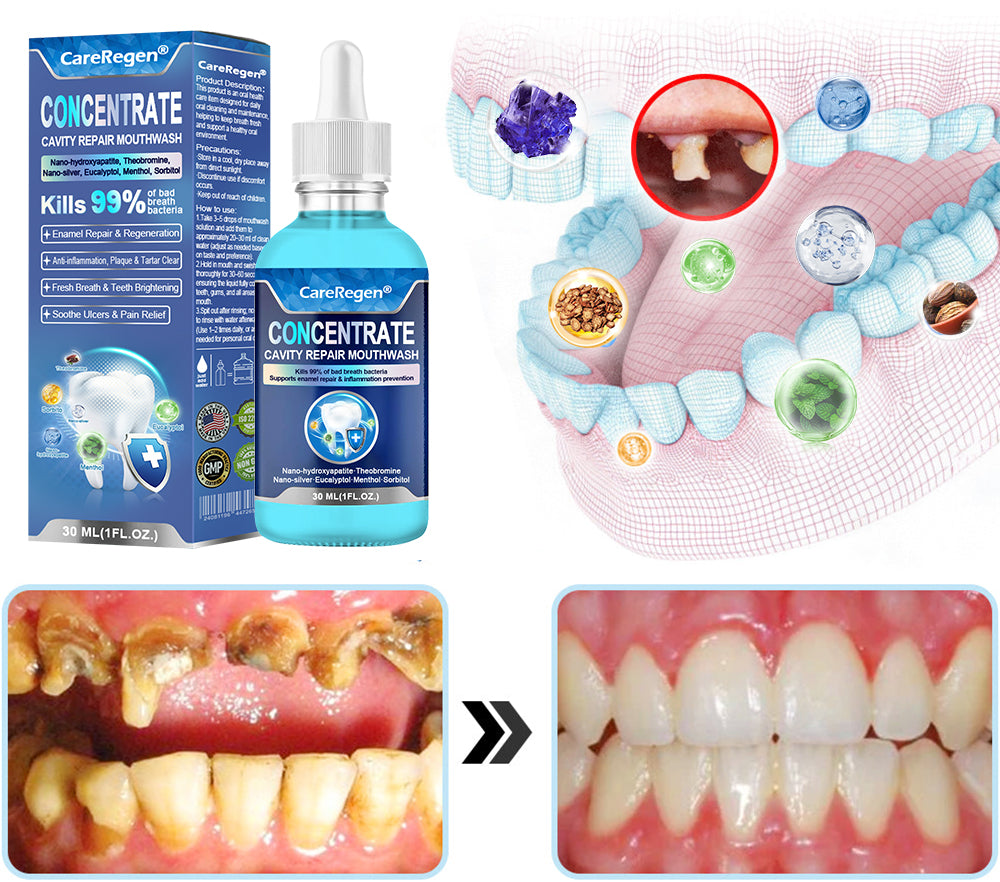 Official Store：🏆CareRegen® CONCENTRATE REPAIR MOUTHWASH(Dentist recommended)(Flying Off the Shelves: 100,000 Bottles Sold!)🎀