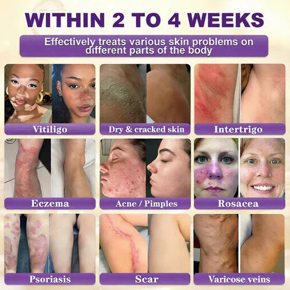 Made and Shipped from UK ✨Healrize® Biotin 10-in-1 Skin Restoration Cream 🍀