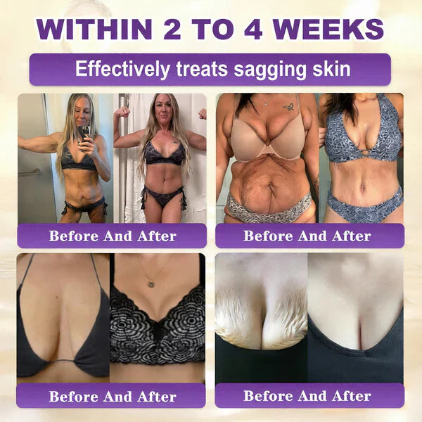 Made and Shipped from UK ✨Healrize® Biotin 10-in-1 Skin Restoration Cream 🍀