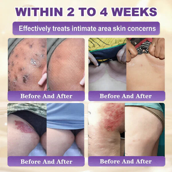 Made and Shipped from UK ✨Healrize® Biotin 10-in-1 Skin Restoration Cream 🍀