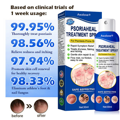 Awzlove® PsoriaHeal  Treatment Spray(Suitable for all skin conditions)