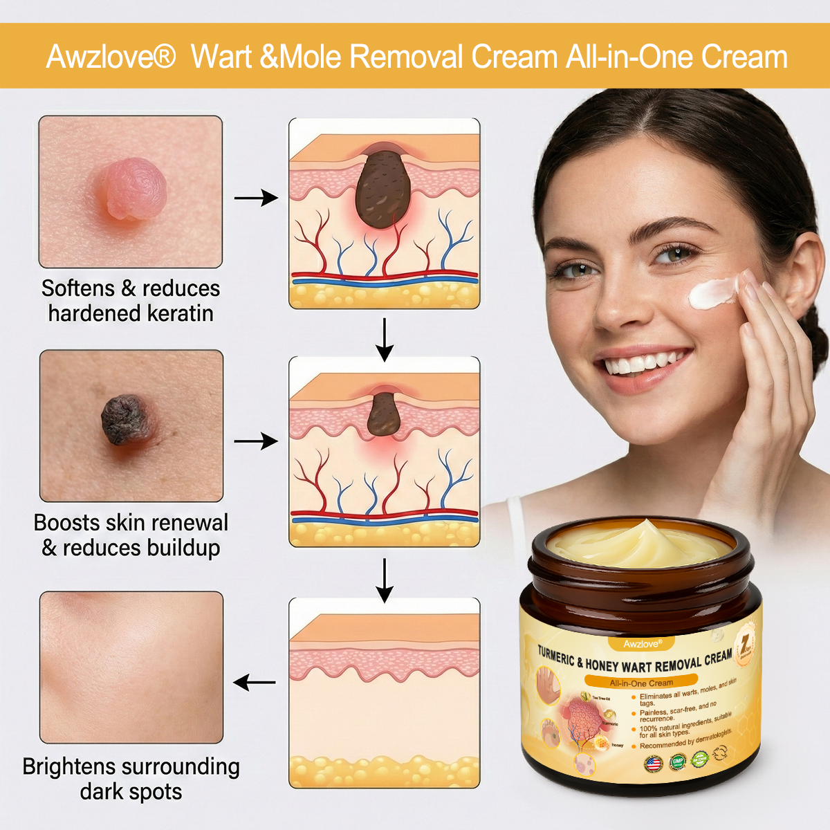 Awzlove® Turmeric & Honey Wart Removal All-in-One Cream