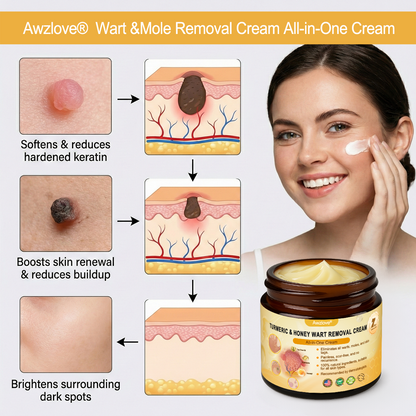 Awzlove® Turmeric & Honey Wart Removal All-in-One Cream