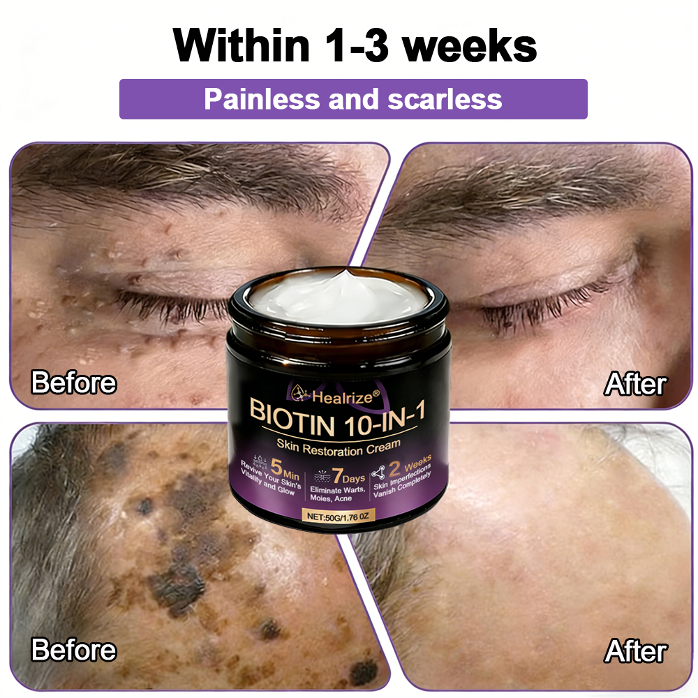 Made and Shipped from UK ✨Healrize® Biotin 10-in-1 Skin Restoration Cream 🍀