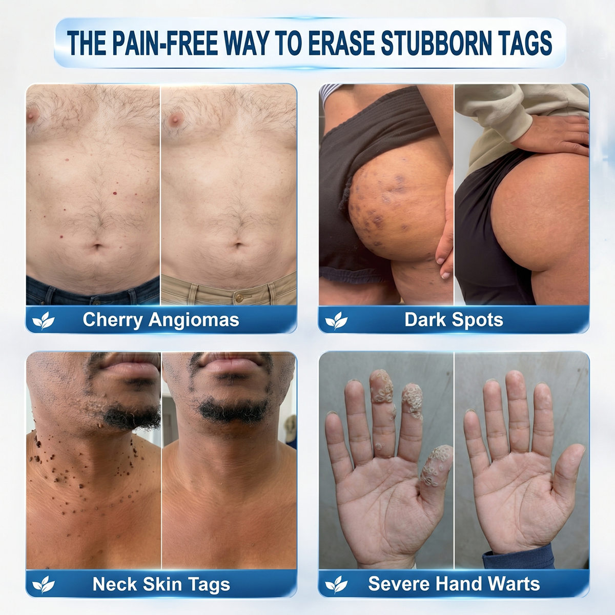 𝐇e𝐚𝐥𝐫i𝐳e® 7-𝐷𝑎𝑦 𝗧𝐚𝐠 & 𝗦𝗽𝐨𝐭 𝐄𝐫𝒂𝒔𝒆𝒓(Zero Pain, Zero 𝐒𝐜𝐚𝒓𝒔 Rollerball)💯