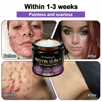 Made and Shipped from UK ✨Healrize® Biotin 10-in-1 Skin Restoration Cream 🍀
