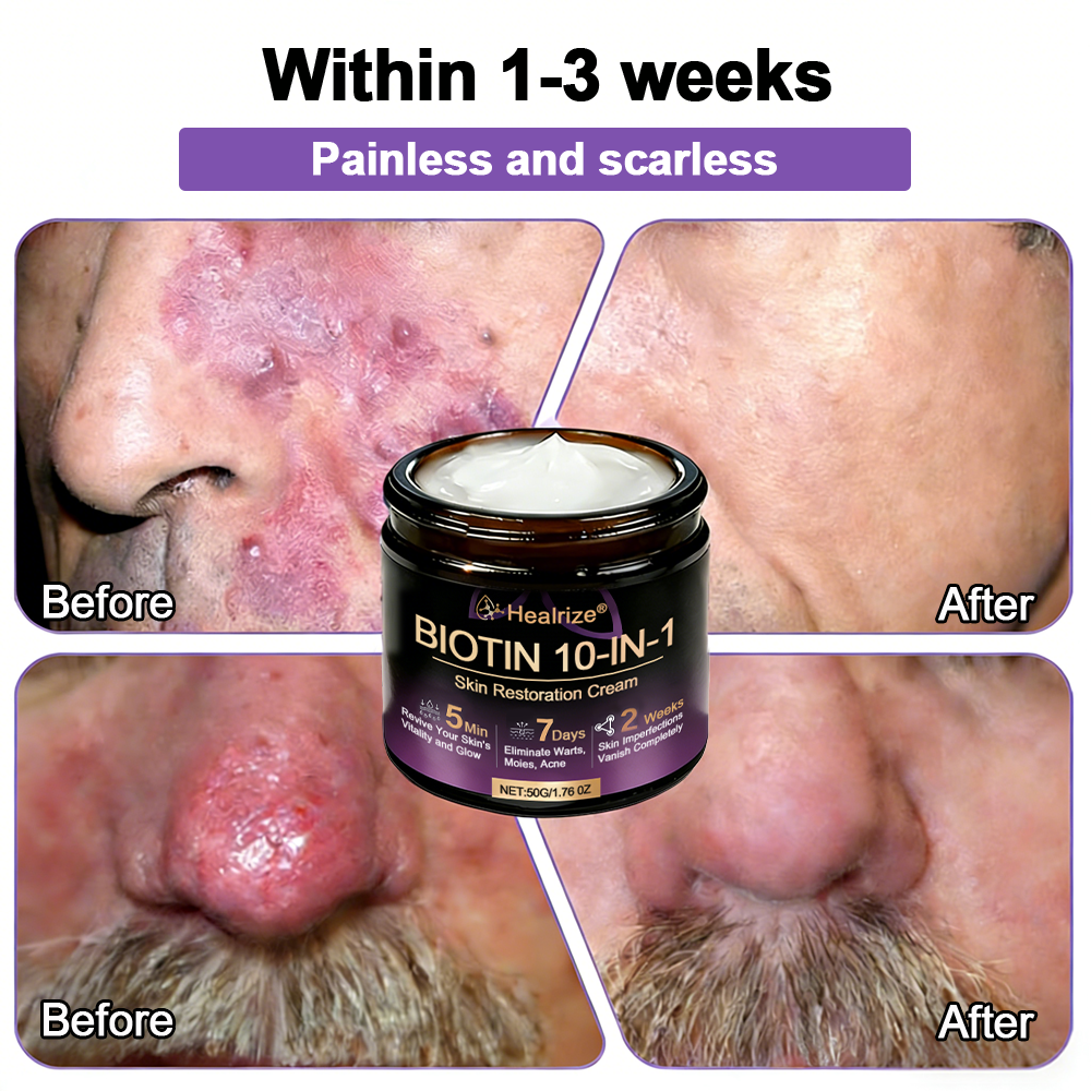 Made and Shipped from UK ✨Healrize® Biotin 10-in-1 Skin Restoration Cream 🍀