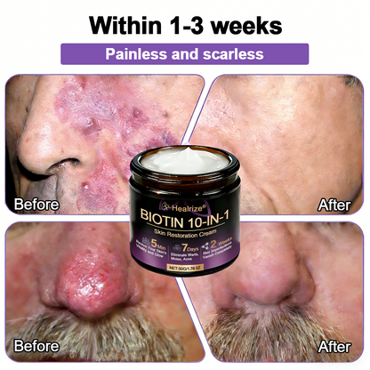 Made and Shipped from UK ✨Healrize® Biotin 10-in-1 Skin Restoration Cream 🍀