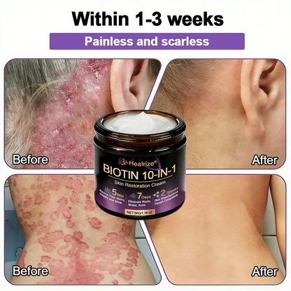 Made and Shipped from UK ✨Healrize® Biotin 10-in-1 Skin Restoration Cream 🍀