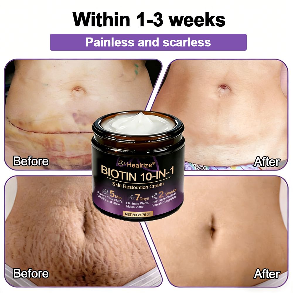 Made and Shipped from UK ✨Healrize® Biotin 10-in-1 Skin Restoration Cream 🍀