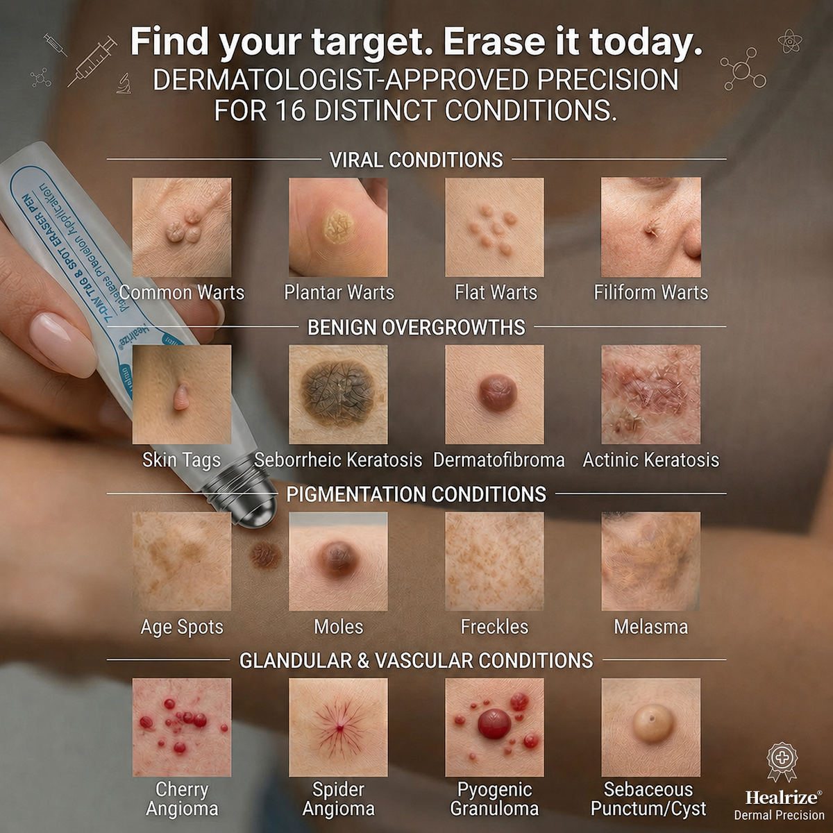𝐇e𝐚𝐥𝐫i𝐳e® 7-𝐷𝑎𝑦 𝗧𝐚𝐠 & 𝗦𝗽𝐨𝐭 𝐄𝐫𝒂𝒔𝒆𝒓(Zero Pain, Zero 𝐒𝐜𝐚𝒓𝒔 Rollerball)💯