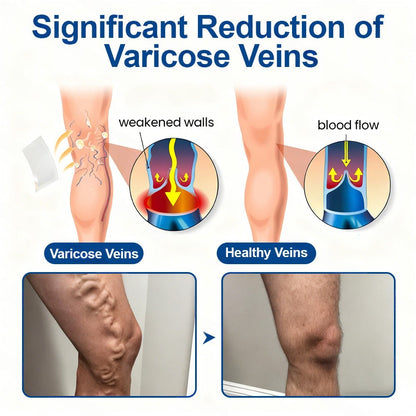 🇺🇸👨‍⚕️👍✅Healrize® VeinTarget Microneedle Patch⚡Instant Relief, Long-Term Results🎁
