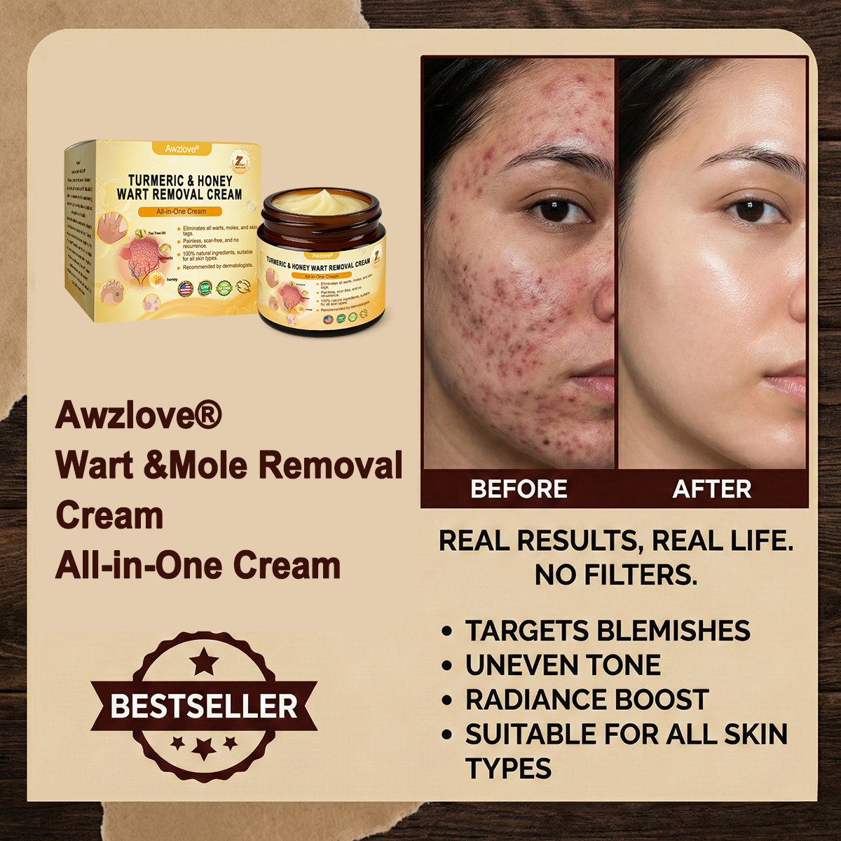 Awzlove® Turmeric & Honey Wart Removal All-in-One Cream