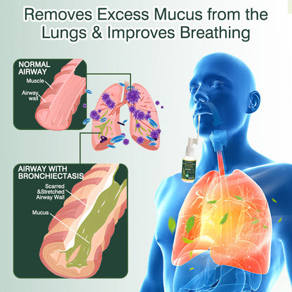 ✅Official Store:CareBreeze® Botanical Mullein Leaf Extract Lung Cleanse Spray（👨‍⚕️Directly acts on COPD, asthma, chronic bronchitis (CB), respiratory infections, lung cancer, sinusitis, and other conditions）