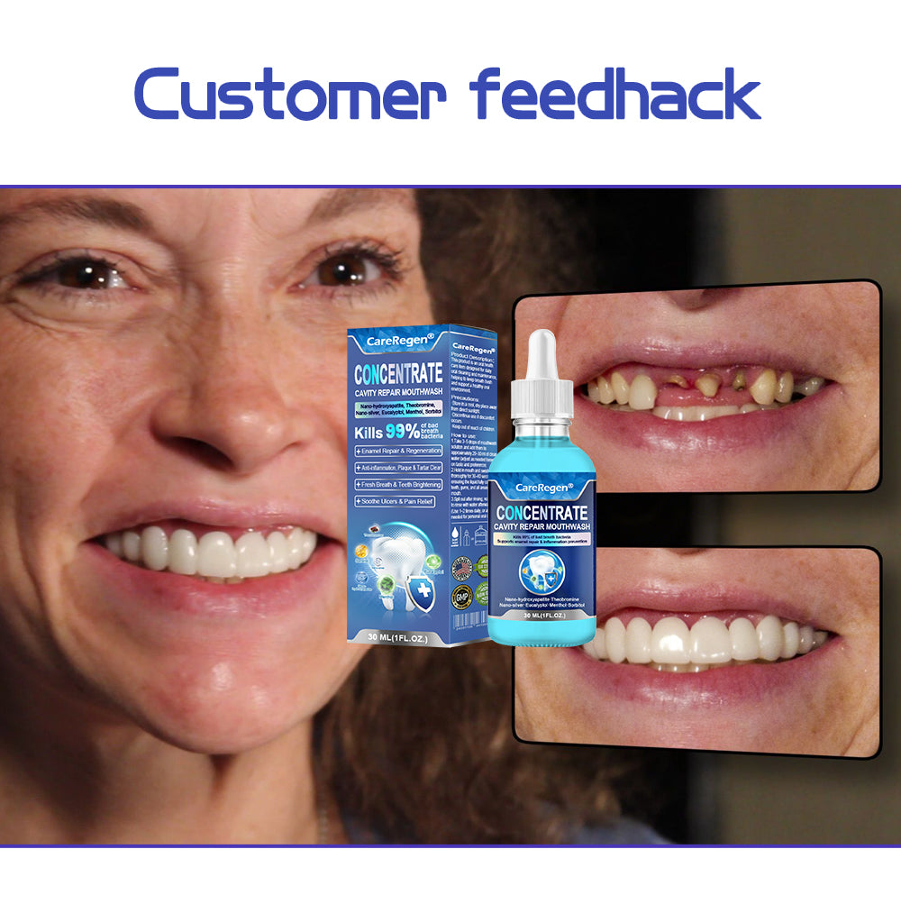 Official Store：🏆CareRegen® CONCENTRATE REPAIR MOUTHWASH(Dentist recommended)(Flying Off the Shelves: 100,000 Bottles Sold!)🎀