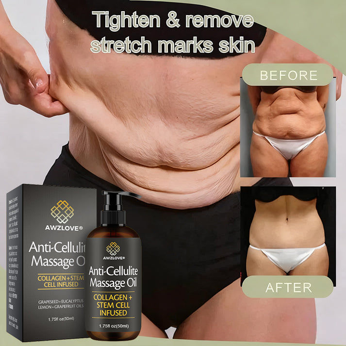 Awzlove® Luxurious Collagen & Stem Cell Anti-Cellulite Massage Oil🎉 (🔥70% Off for a Limited Time!)