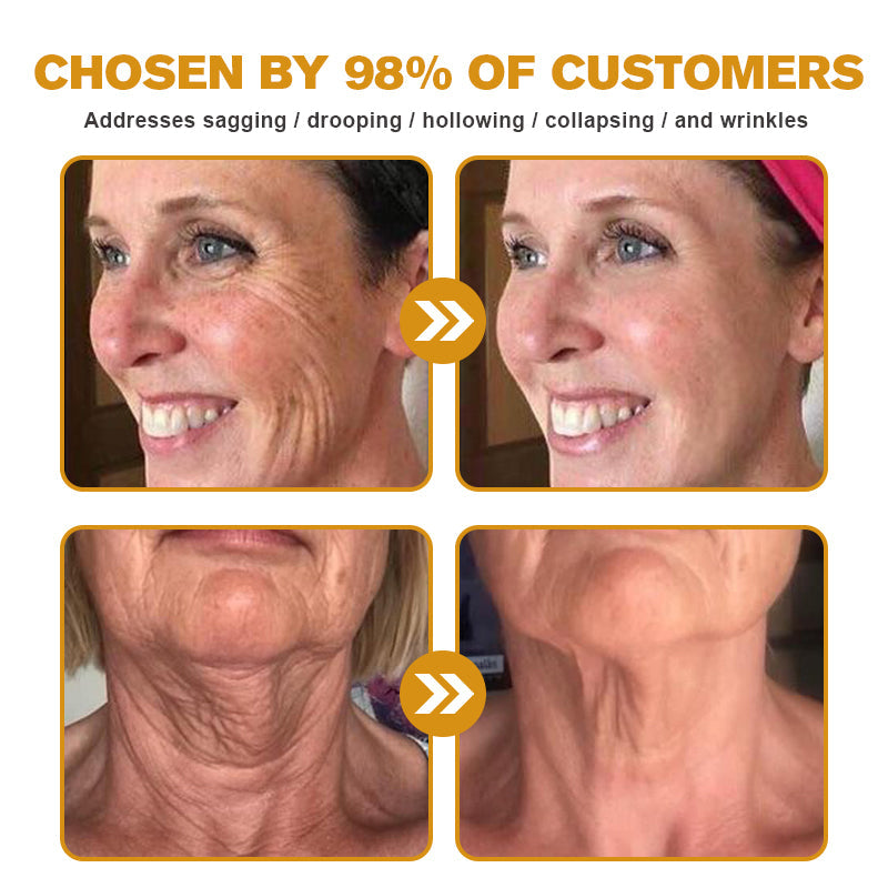 Made and shipped from the US✅--Awzlove® Botox Bee Venom Wrinkle Removal Roll-On Cream-Last Day Promotion 70% OFF 🔥