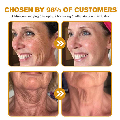 Made and shipped from the US✅--Awzlove® Botox Bee Venom Wrinkle Removal Roll-On Cream-Last Day Promotion 70% OFF 🔥