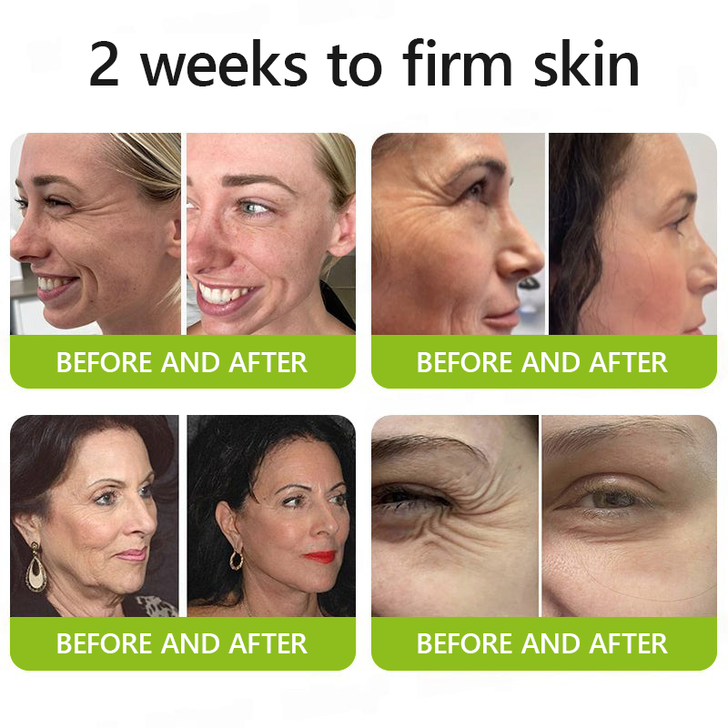 🎖️🎖️🎖️Made and shipped from USA 💫Healrize® Botox & Vita-A Retinol Shot Wrinkle-Lift Tightening cream - Last Day Promotion 70% OFF