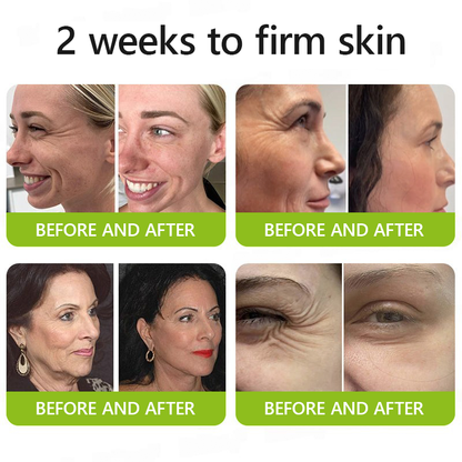 🎖️🎖️🎖️Made and shipped from USA 💫Healrize® Botox & Vita-A Retinol Shot Wrinkle-Lift Tightening cream - Last Day Promotion 70% OFF