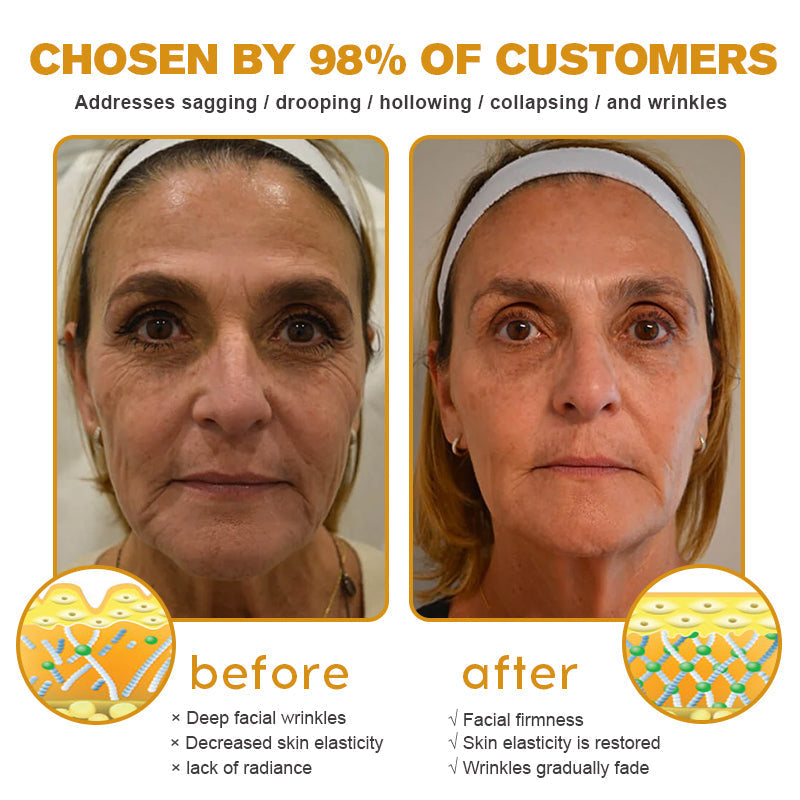 Made and shipped from the US✅--Awzlove® Botox Bee Venom Wrinkle Removal Roll-On Cream-Last Day Promotion 70% OFF 🔥