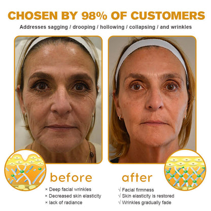 Made and shipped from the US✅--Awzlove® Botox Bee Venom Wrinkle Removal Roll-On Cream-Last Day Promotion 70% OFF 🔥