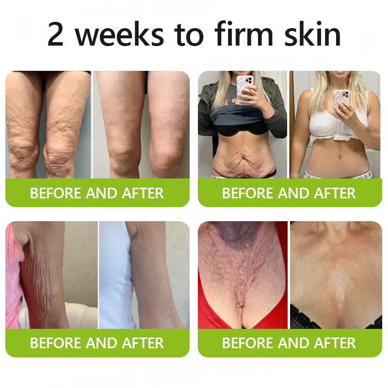🎖️🎖️🎖️Made and shipped from USA 💫Healrize® Botox & Vita-A Retinol Shot Wrinkle-Lift Tightening cream - Last Day Promotion 70% OFF
