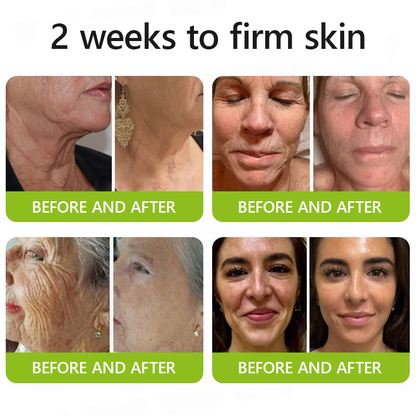 🎖️🎖️🎖️Made and shipped from USA 💫Healrize® Botox & Vita-A Retinol Shot Wrinkle-Lift Tightening cream - Last Day Promotion 70% OFF