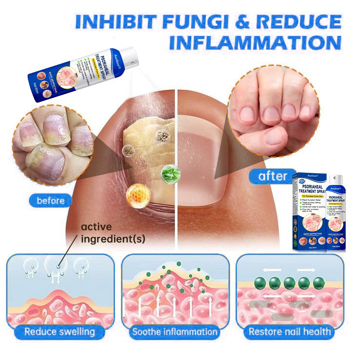 Awzlove® PsoriaHeal  Treatment Spray(Suitable for all skin conditions)