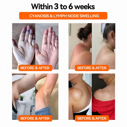 TIMNAMY®👩‍⚕️🧬 Ultrasound Fat Breakdown and Far-Infrared Detoxifying Blood Sugar Balancing Bracelet