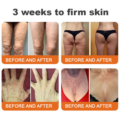 Awzlove® Luxurious Collagen & Stem Cell Anti-Cellulite Massage Oil🎉 (🔥70% Off for a Limited Time!)