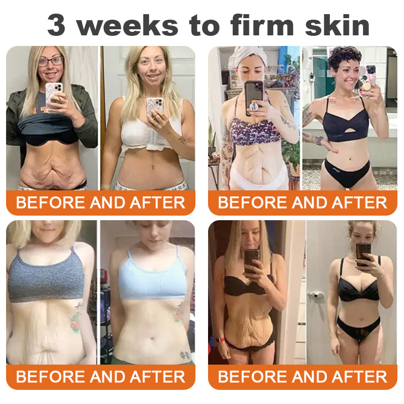 Awzlove® Luxurious Collagen & Stem Cell Anti-Cellulite Massage Oil🎉 (🔥70% Off for a Limited Time!)