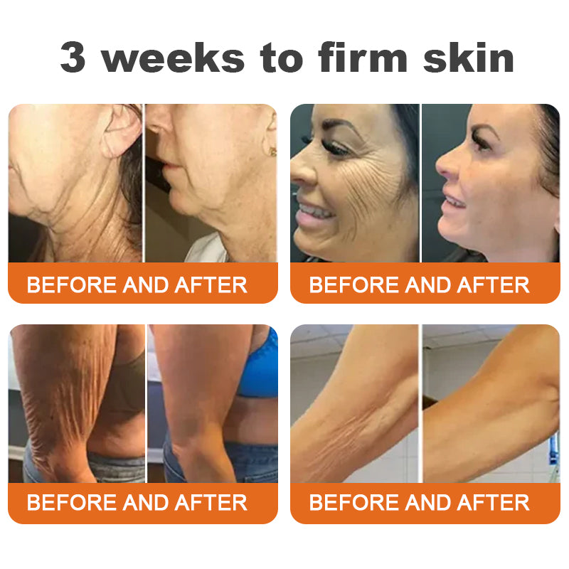 Awzlove® Luxurious Collagen & Stem Cell Anti-Cellulite Massage Oil🎉 (🔥70% Off for a Limited Time!)