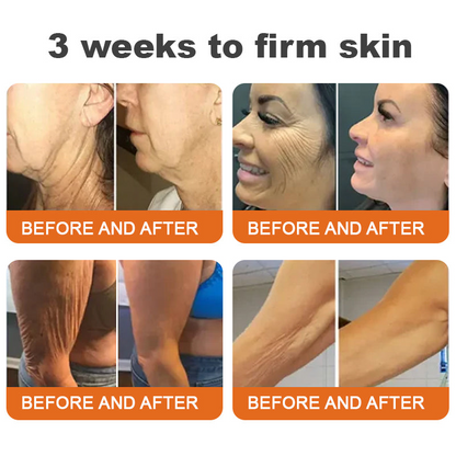 Awzlove® Luxurious Collagen & Stem Cell Anti-Cellulite Massage Oil🎉 (🔥70% Off for a Limited Time!)